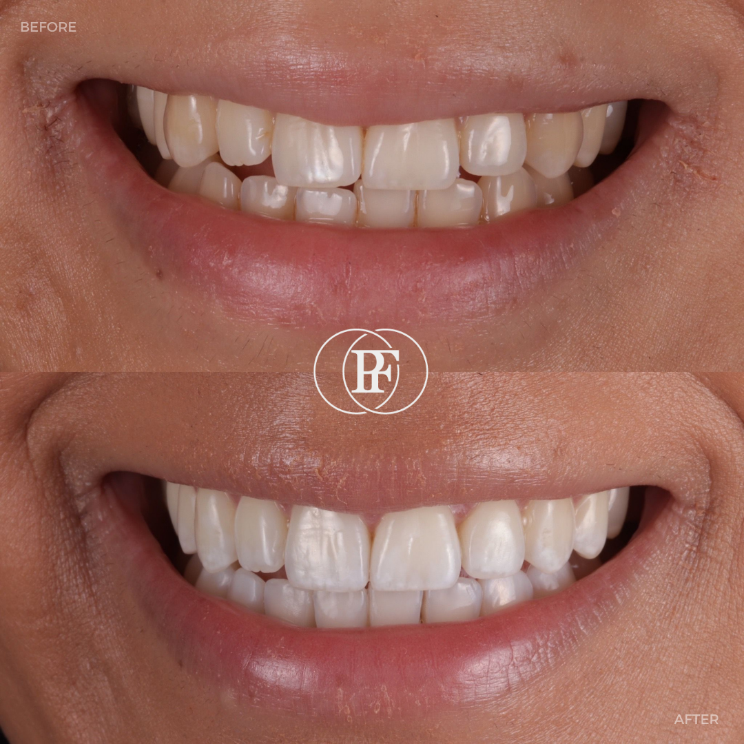 Oris Dental & Implant Studio Smile Makeovers in Dundee Oris Dental & Implant Studio Smile Makeovers in Dundee