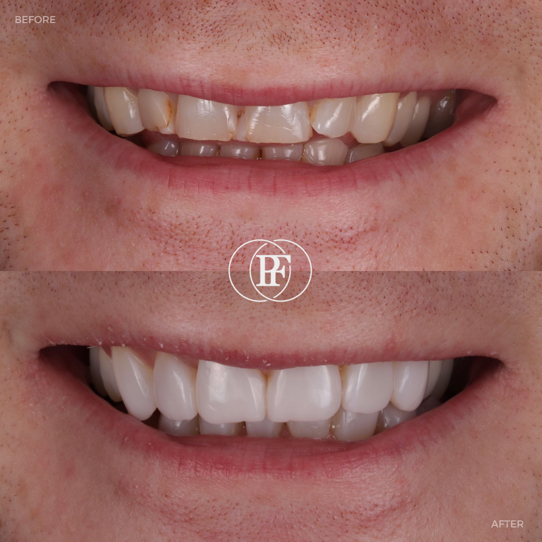 Oris Dental & Implant Studio Smile Makeovers in Dundee Oris Dental & Implant Studio Smile Makeovers in Dundee