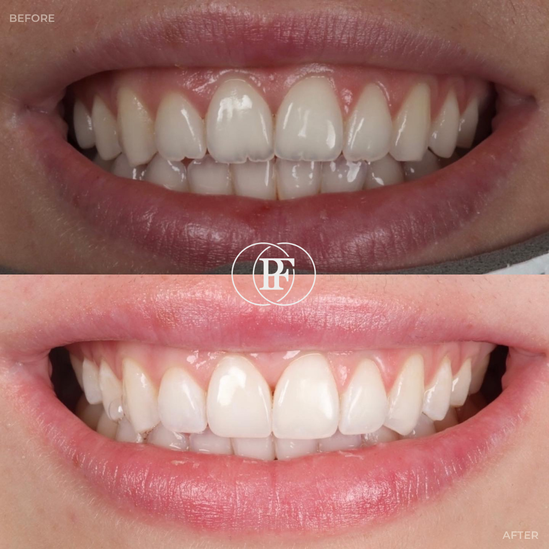 Oris Dental & Implant Studio Smile Makeovers in Dundee Oris Dental & Implant Studio Smile Makeovers in Dundee