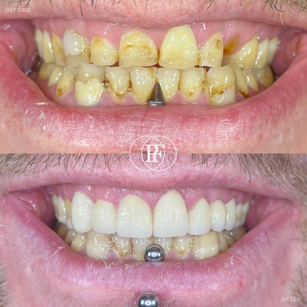 Oris Dental & Implant Studio Smile Makeovers in Dundee Oris Dental & Implant Studio Smile Makeovers in Dundee