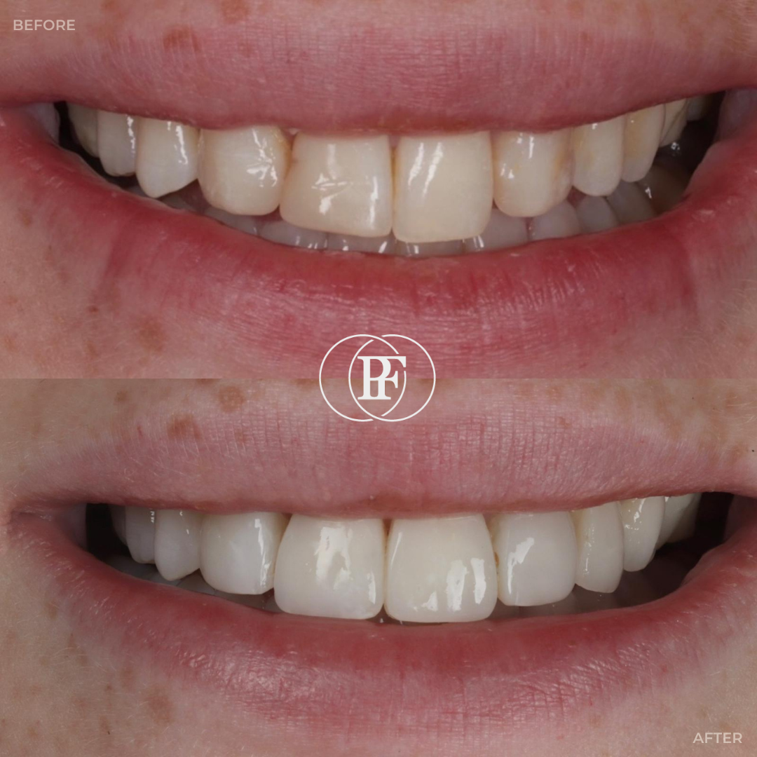 Oris Dental & Implant Studio Smile Makeovers in Dundee Oris Dental & Implant Studio Smile Makeovers in Dundee