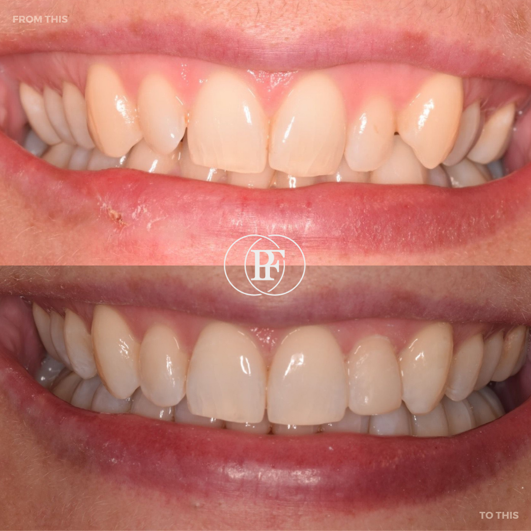 Oris Dental & Implant Studio Smile Makeovers in Dundee Oris Dental & Implant Studio Smile Makeovers in Dundee